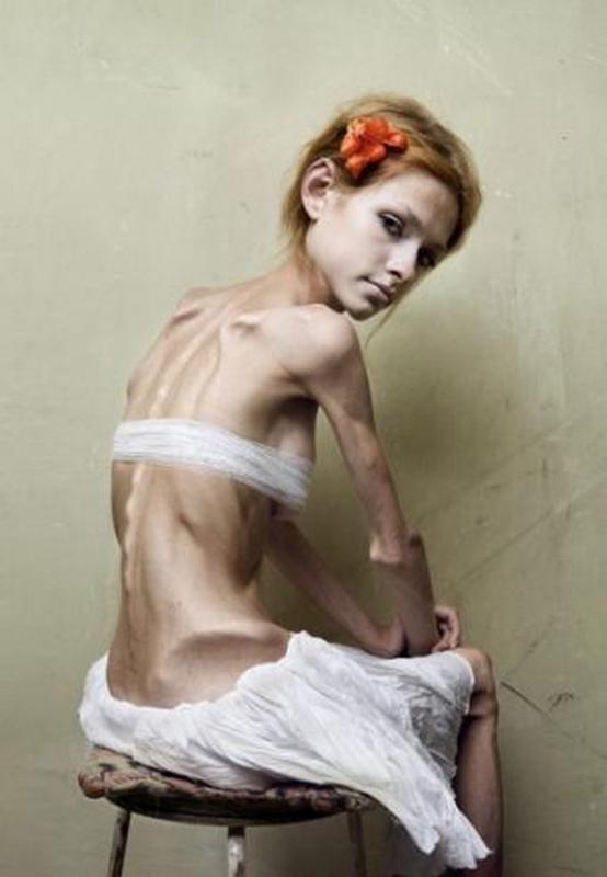 anorexic-models-09.jpg