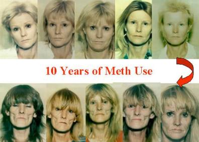 face_meth-396x283.jpg