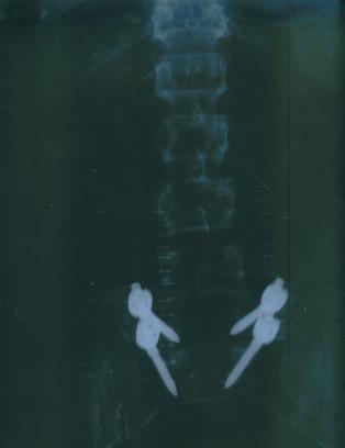 xray1.jpg